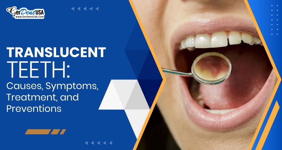 Translucent Teeth: Causes, Symptoms, Treatment, and Prevention