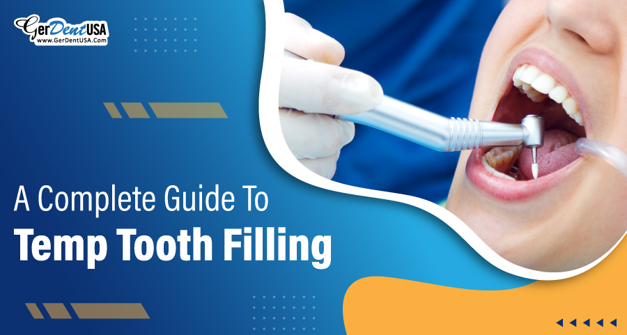 A Complete Guide to Temp Tooth Filling