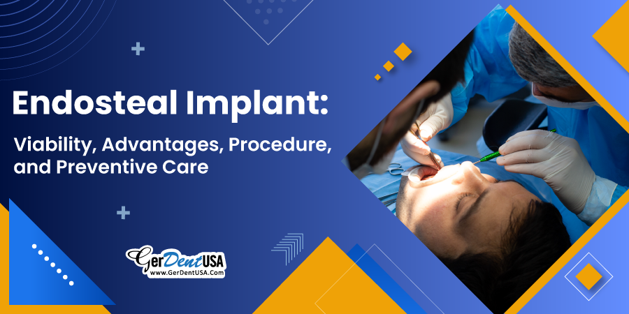 Endosteal Implant: Viability, Advantages, Procedure, and Preventive Care