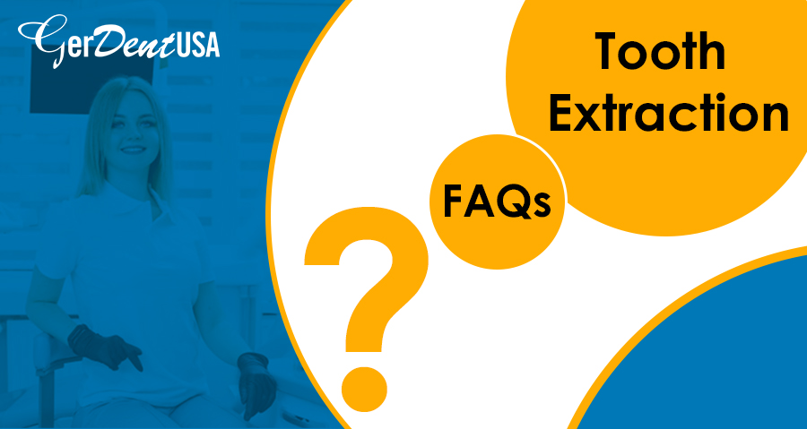 Frequently Asked Questions about Tooth Extraction