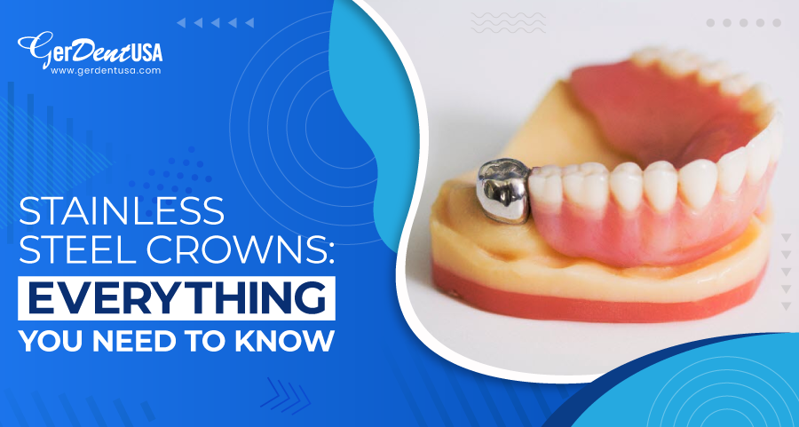 Stainless Steel Crowns: Everything You Need to Know