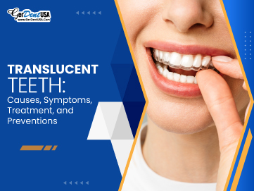 Translucent Teeth: Causes, Symptoms, Treatment, and Prevention